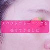 スペクトラトーニング（ルートロピール）を受けてきました！【1回だけじゃ意味ないの？】
