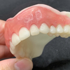 ３Dプリントデンチャーの歯肉・歯冠をズレなく接着するために③「ベニアデンチャー」のススメ（Medit Splints使用）