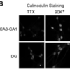  Calmodulin priming: nuclear translocation of a calmodulin complex and the memory of prior neuronal activity.