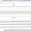 【 兵庫 ０．１０６ μ 】　（＋補遺っ）