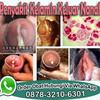 Obat Kencing Sakit Pada Pria Di Apotik De Nature