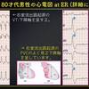 ECG-212：answer-2/2:詳細に読む