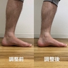 足部のアーチを作る調整方法