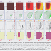 Elastic Boundary Projection for 3D Medical Image Segmentation