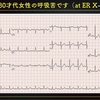 ECG-308：80才代女性です。入院後の呼吸苦です。