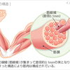 【徹底解説】筋肉痛の時って筋トレしてもいいの？