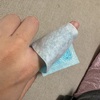 【指】折れてるのかと思った