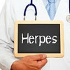 Obat penyakit kulit herpes