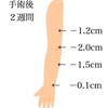 ２週間でマイナス２cm！