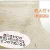 首周り・胸元(デコルテ)の茶色のブツブツ老人性イボの正体とお勧めイボ取り方法