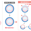 受診17回目　移植周期