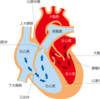 大動脈解離・心臓弁膜症をまとめてみた！