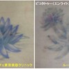 腰の黒と紫の花のタトゥーのインクを取っています。