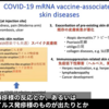 コロナワクチンは、ワクチンではなく、遺伝子を導入する医薬品：19:20～。　ワクチン皮膚病