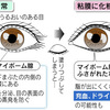 アイメークによる目のトラブル