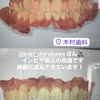 インビザも順調！