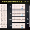 ECG-244：answer