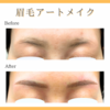 アートメイクはアトピー性皮膚炎で薄くなった眉にもお勧めです