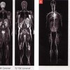 　Whole Body Imaging