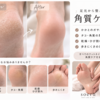 足の乾燥がひどい人の特徴｜何をしても治らない本当の原因とは？