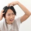 増毛と植毛は男性の大きな悩みを解決してくれる。