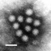 Norovirus