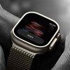 Apple Watch300万日分のデータで病気を予測する新AIモデル「JETS」とは