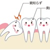 親知らずはお口の中で悪さをするかも・・・