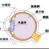 白内障