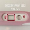 体外受精：妊娠判定