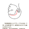 未破裂脳動脈瘤【手術のことをまとめてみる】右内頚動脈瘤のクリッピング術