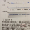 睡眠時無呼吸の兆候と危険性を実際の患者であるわたしが語る