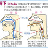 じじぃの「カオス・地球_263_すばらしい医学・喉の優れたしくみの功罪・誤嚥性肺炎」