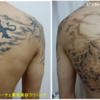 背中一面の黒と赤２色タトゥーが薄くなります
