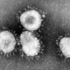 Wikipedia 英語記事「Coronavirus / コロナウイルス」の日本語訳 その1