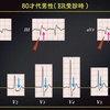 ECG-275:answer