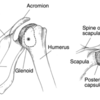 肩関節後方関節包の拘縮について