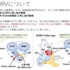 DORV(両大血管右室起始症)　その4　{S.D.N}DORV VSD type、左室流出路狭窄(LVOTO)について　　〜疾患39