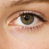 目の病気（中心性漿液性脈絡網膜症）について、レーザー治療をせずに良くなりました♬ 