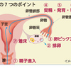 腹腔鏡手術（ラパロ）〜その１〜