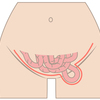 鼠径ヘルニア終診