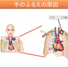 手の震えは、パーキンソン病？