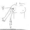 乳腺炎は恐ろしい