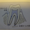 放置が怖い！虫歯や歯周病が二次疾患を引き起こす。