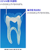 象牙質とエナメル質の比較