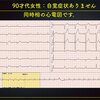 ECG-359：今回はリズムの問題です。症状ありません。 = 心電図検定試験：傾向と対策 Q.007 =