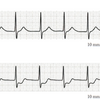 第55回午前7　―　心電図