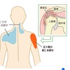 五十肩かな