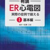 心電図の勉強、145日目。～RR間隔が変動する広いQRS幅の頻拍（Irregular wide QRS tachycardia）～