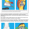 Dealing With Mortons Neuroma